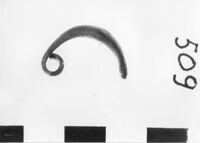 fibula ad arco ingrossato