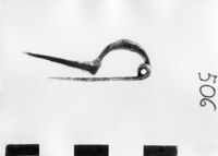 fibula ad arco ingrossato